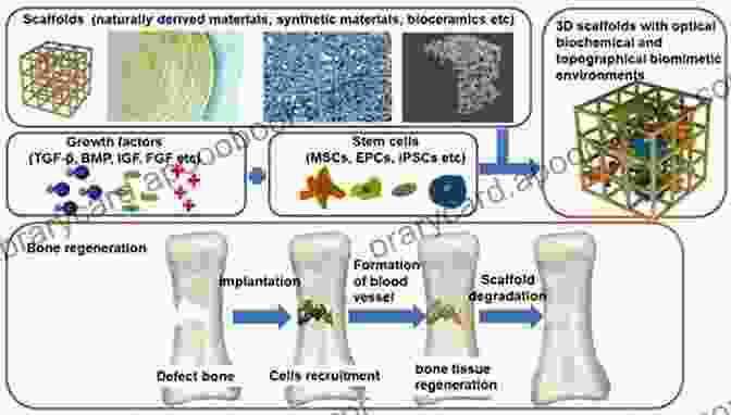 Bioceramics For Bone Repair And Regeneration Materials And Devices For Bone DisFree Downloads