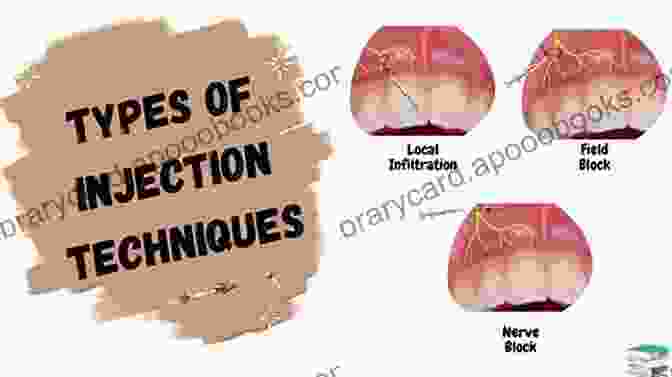 Local Anesthesia Being Administered Through An Injection Need Surgery? Now What? A Patient S Guide To Anesthesia