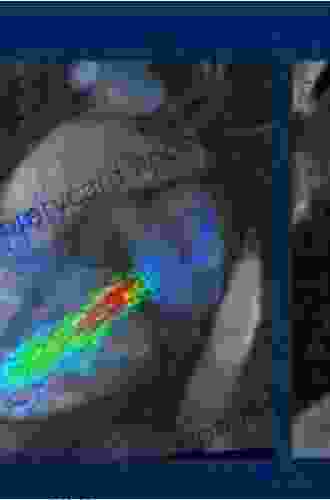 Learning Cardiac Magnetic Resonance: A Case Based Guide