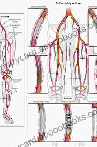 Vascular Complications of Surgery and Intervention: A Practical Guide